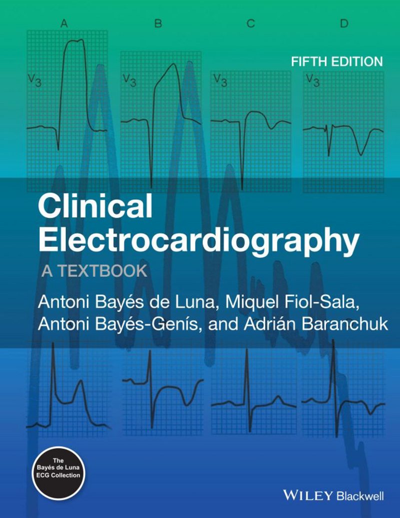 Clinical Electrocardiography: A Textbook 5th Edition