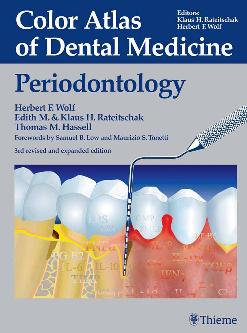 Color Atlas of Dental Medicine Periodontology 3rd Edition