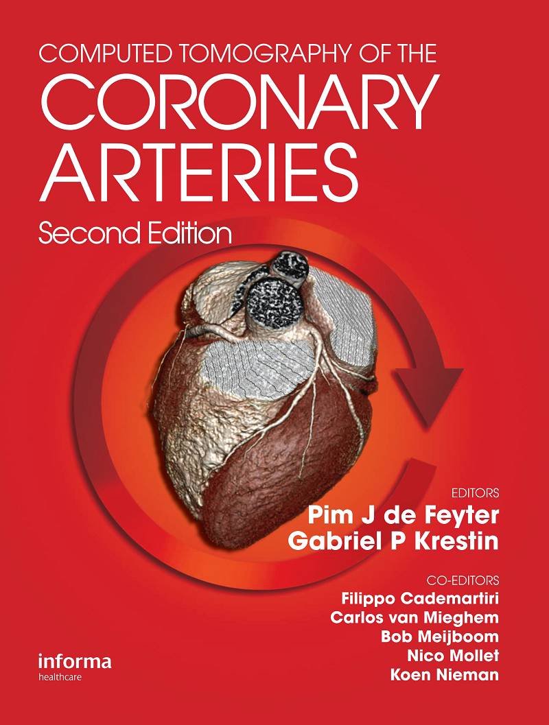 Computed Tomography of the Coronary Arteries 2nd Edition