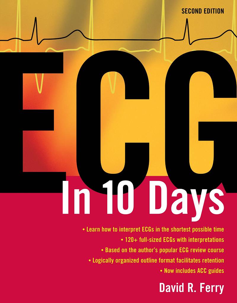 ECG in Ten Days 2nd Edition