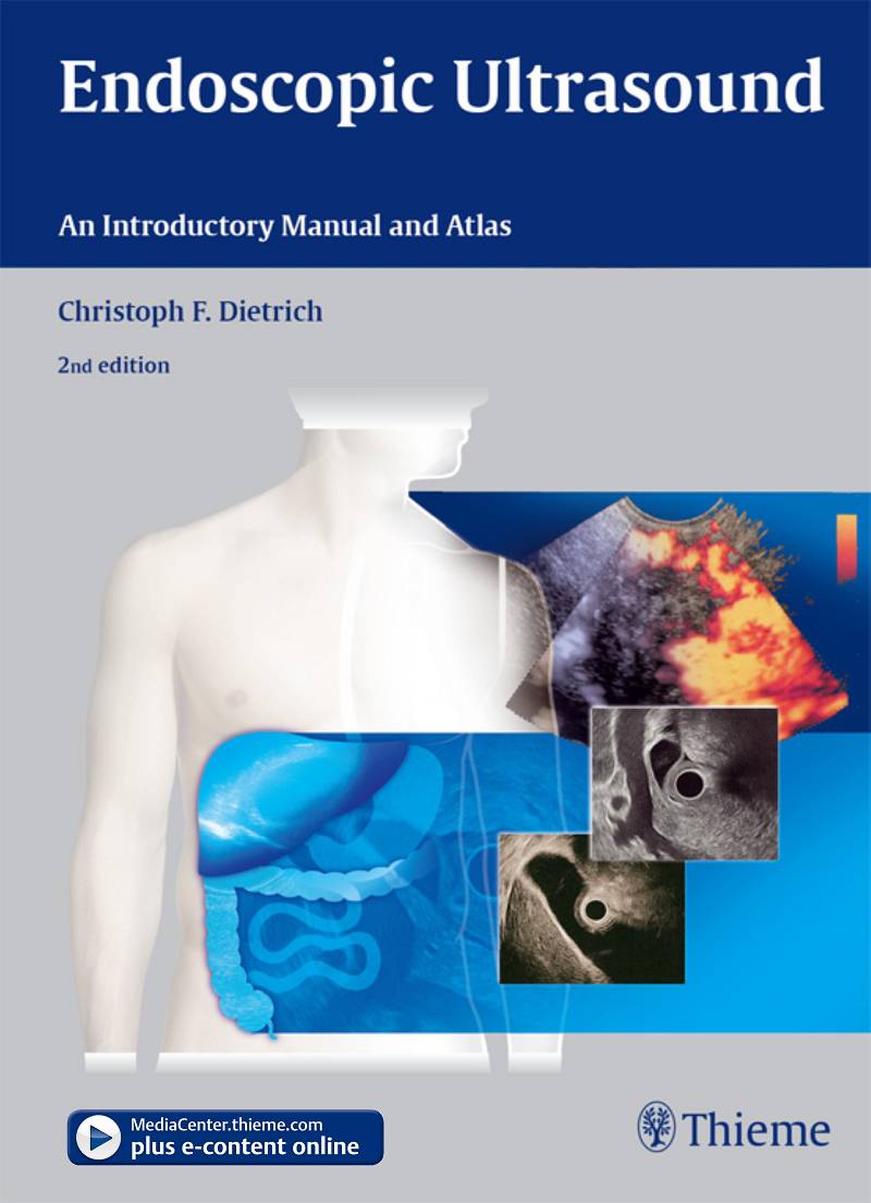 Endoscopic Ultrasound An Introductory Manual and Atlas 2nd Edition