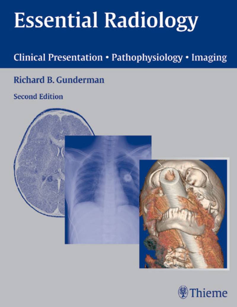 Essential Radiology Clinical Presentation Pathophysiology Imaging 2nd Edition