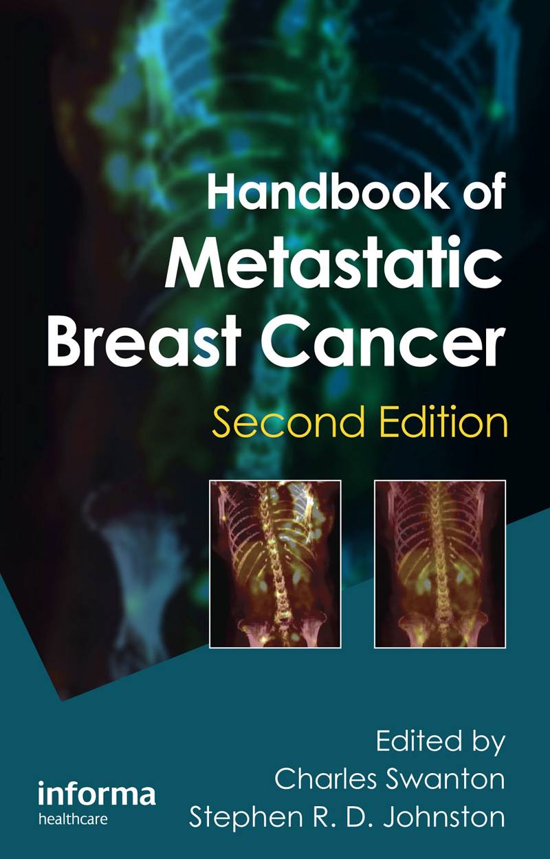 Handbook of Metastatic Breast Cancer 2nd Edition