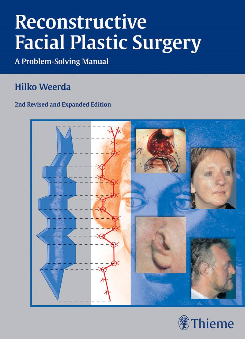 Reconstructive Facial Plastic Surgery A Problem-Solving Manual 2nd Edition