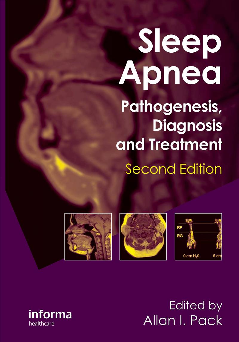 Sleep Apnea Pathogenesis Diagnosis and Treatment 2nd Edition